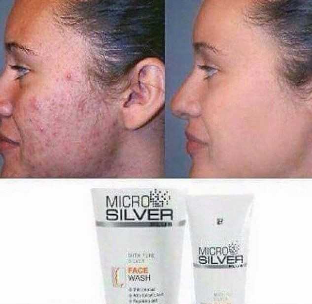 Microsillver Plus Face Care 